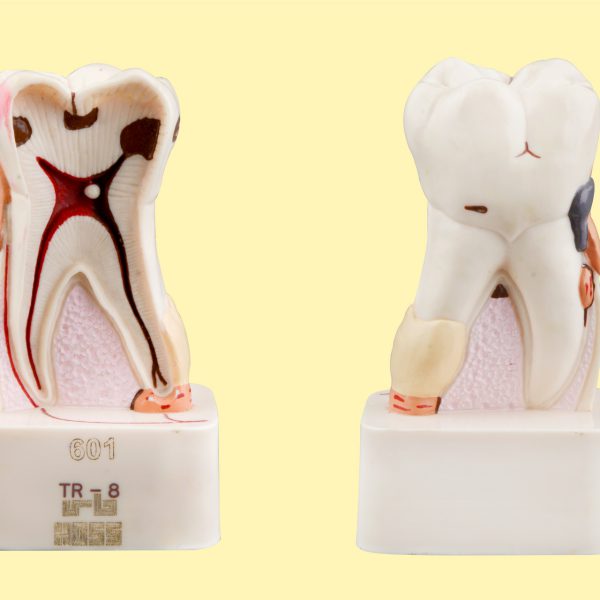 پاتولوژی دندان