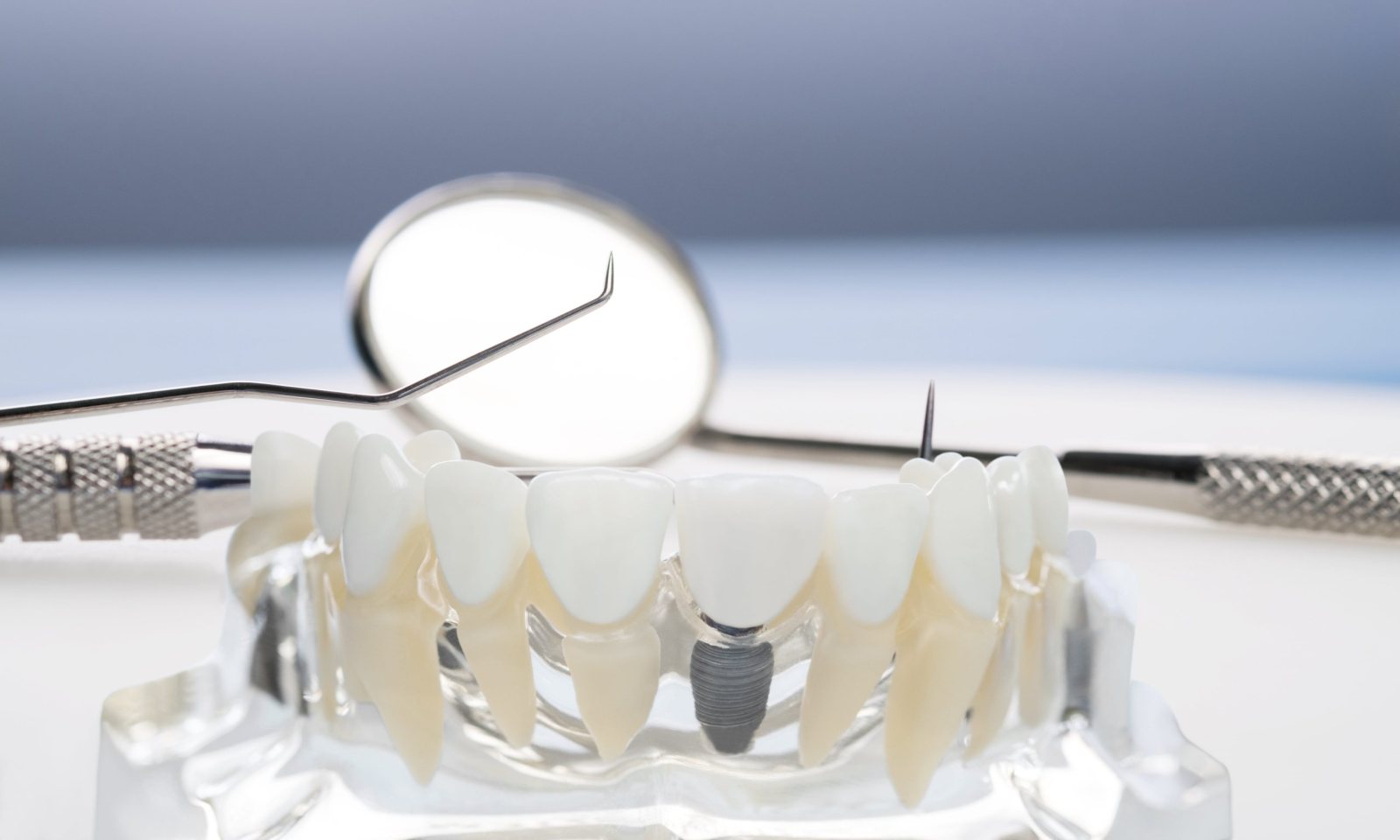 تفاوت دندان آکریلی و دندان طبیعی